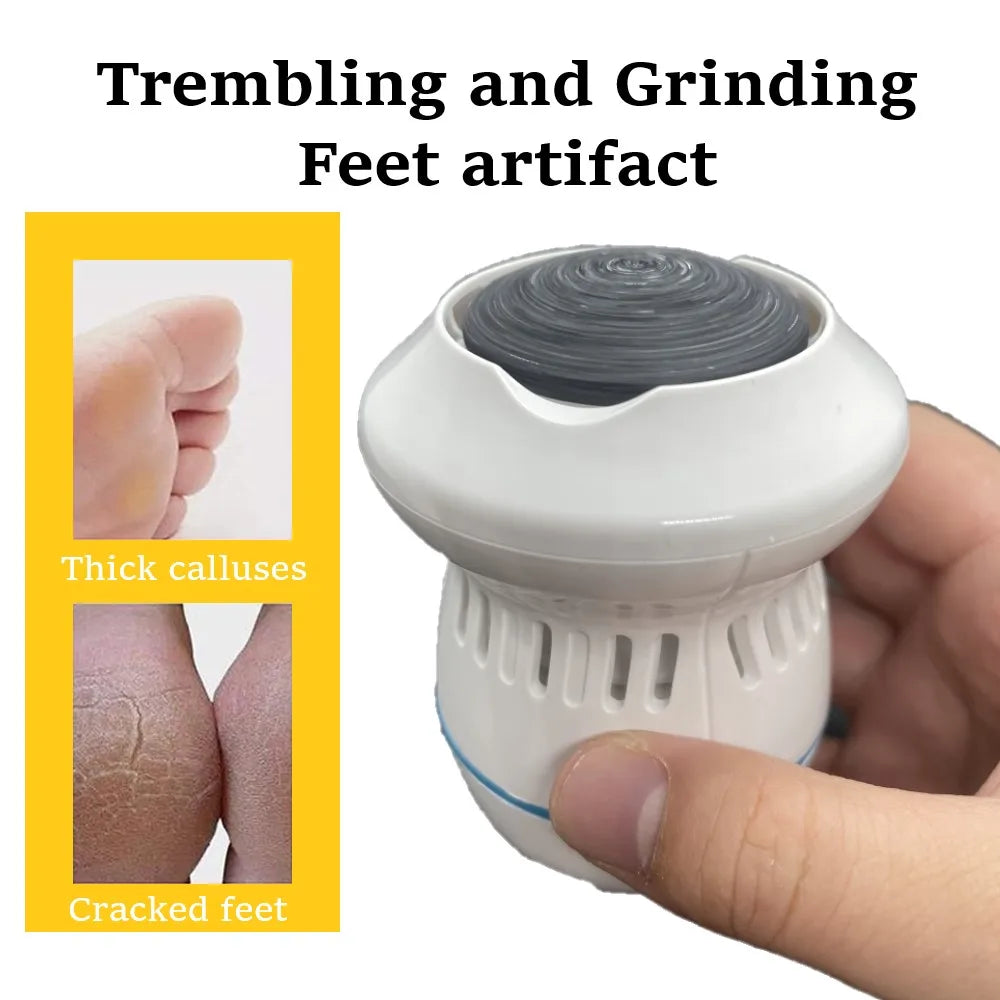 Vacuum Callus Remover - DREAMZCART